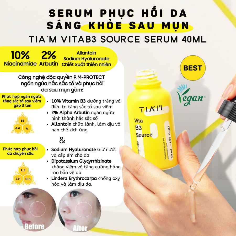 Bộ 3 Tia'm Serum Niacinamide 10%, Serum Bakuchiol, Kem Dưỡng Niacinamide 60ml — 3