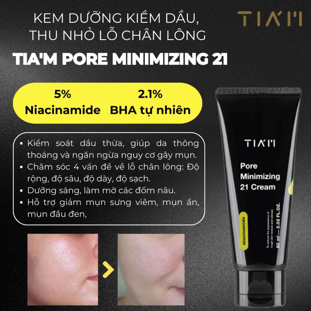 Bộ 3 Tia'm Serum Niacinamide 10%, Serum Bakuchiol, Kem Dưỡng Niacinamide 60ml — 5